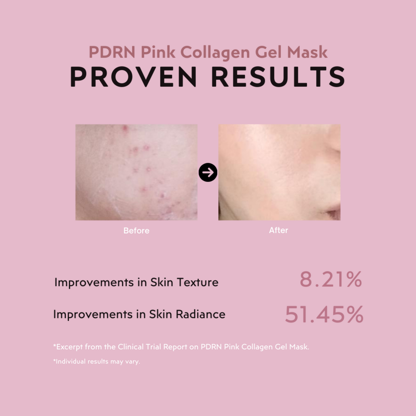 Salmon PDRN Collagen Mask (4 Masks)